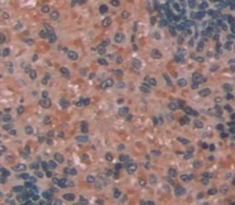 Polyclonal Antibody to Cluster Of Differentiation 14 (CD14)