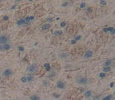 Polyclonal Antibody to Neuropilin 1 (NRP1)