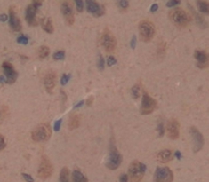 Polyclonal Antibody to Neuropilin 1 (NRP1)