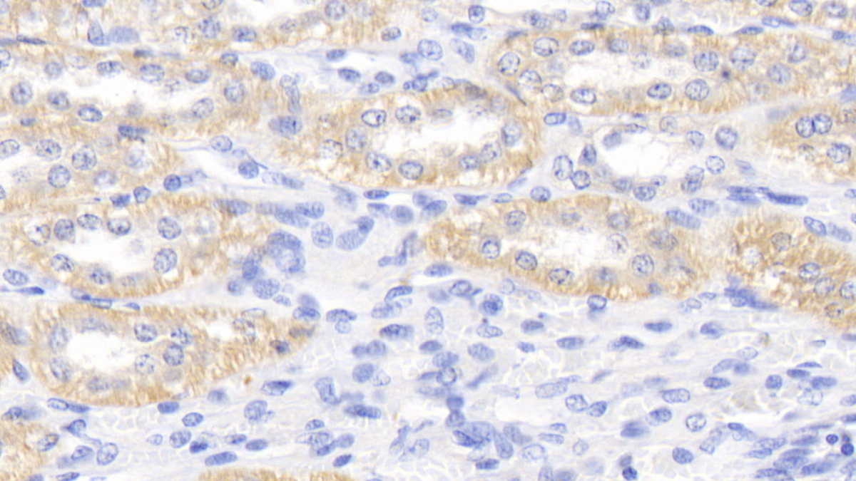 Polyclonal Antibody to Apolipoprotein E (APOE)