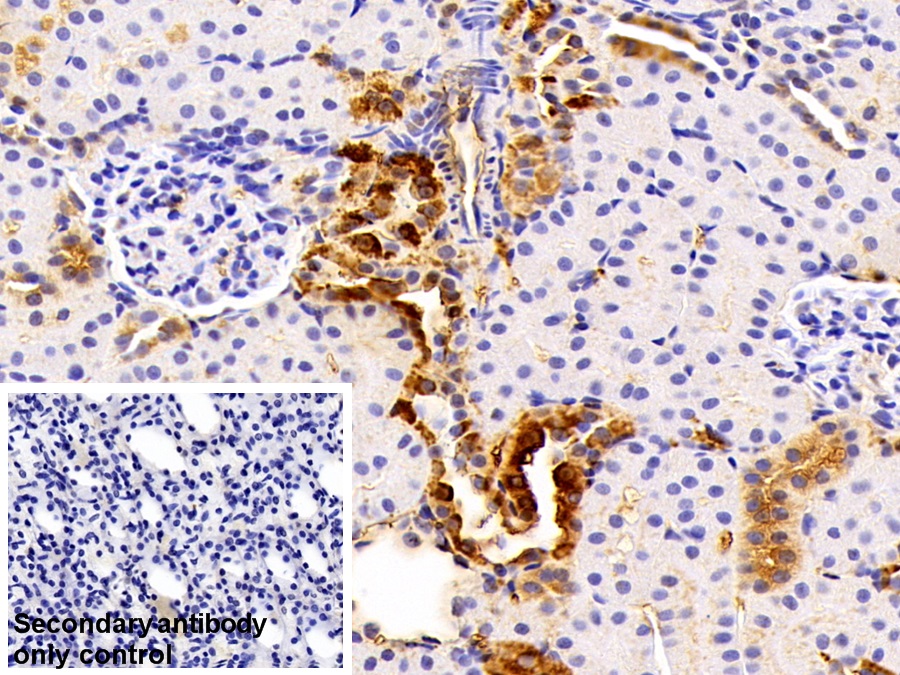 Polyclonal Antibody to Apolipoprotein E (APOE)