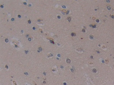 Polyclonal Antibody to Toll Like Receptor 9 (TLR9)
