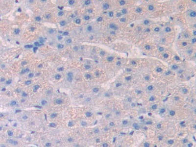 Polyclonal Antibody to Heparanase (HPSE)