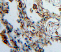 Polyclonal Antibody to Heparanase (HPSE)