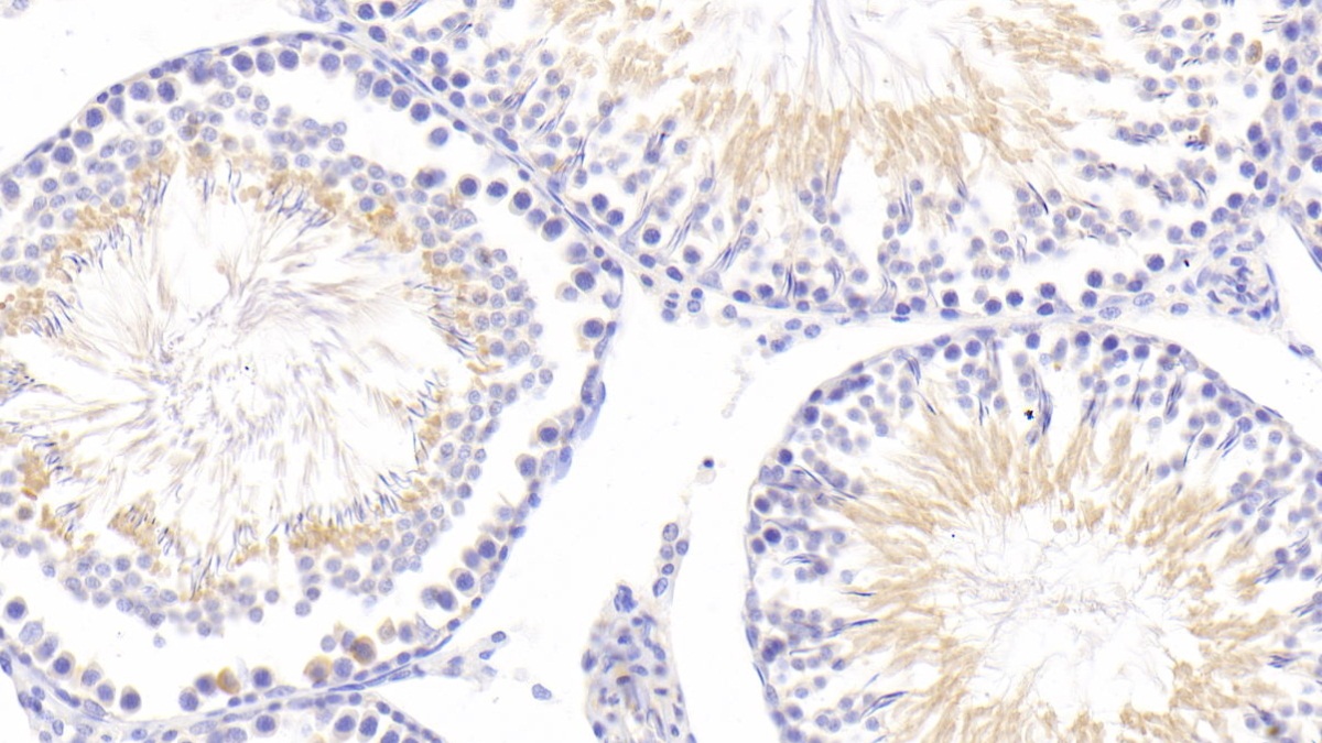 Polyclonal Antibody to Beta-Site APP Cleaving Enzyme 1 (bACE1)