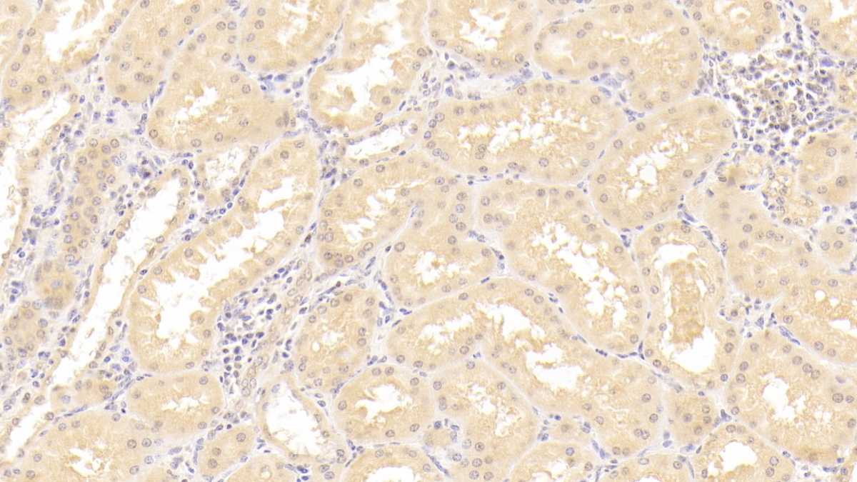 Polyclonal Antibody to Complement Component 7 (C7)