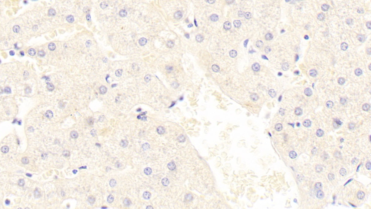 Polyclonal Antibody to Complement Component 7 (C7)