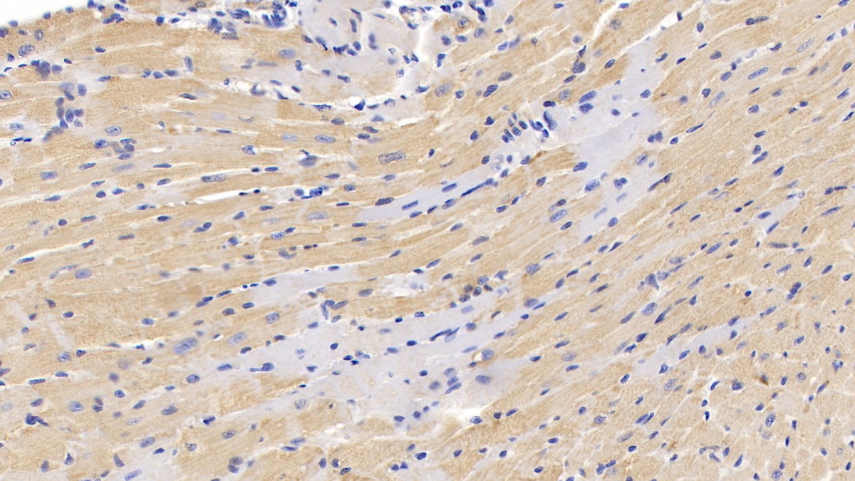 Polyclonal Antibody to Mucin 5 Subtype AC (MUC5AC)