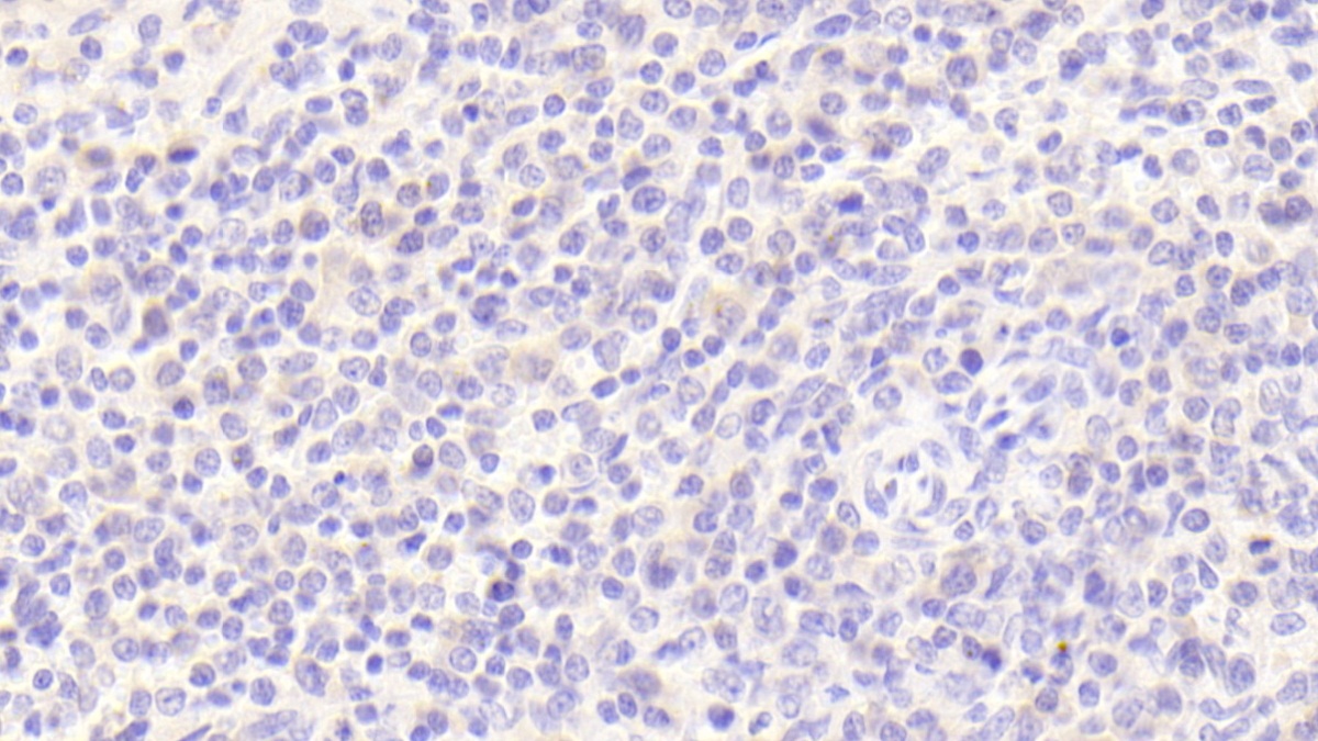 Polyclonal Antibody to Complement Factor P (CFP)