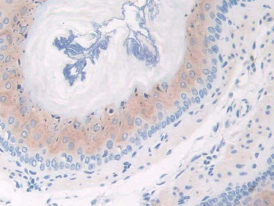 Polyclonal Antibody to Complement Factor P (CFP)