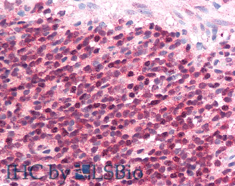 Polyclonal Antibody to Inducible T-Cell Co Stimulator Ligand (ICOSLG)