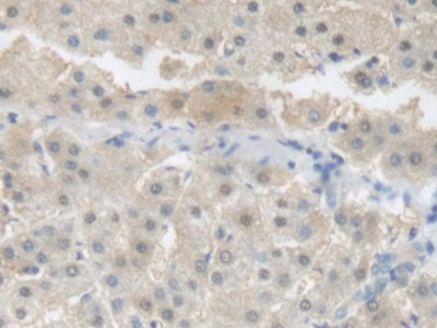 Polyclonal Antibody to C Reactive Protein (CRP)