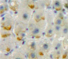 Polyclonal Antibody to Cluster Of Differentiation 86 (CD86)