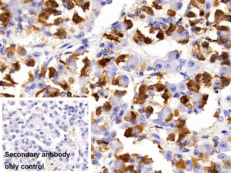 Polyclonal Antibody to Prolactin (PRL)