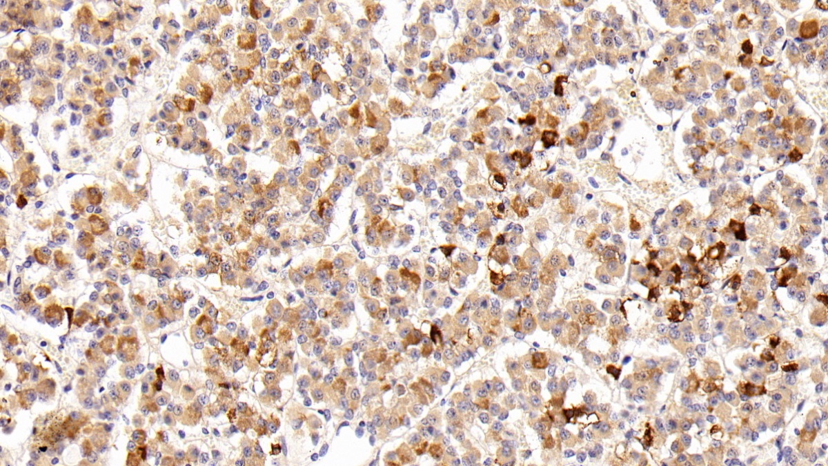 Polyclonal Antibody to Prolactin (PRL)