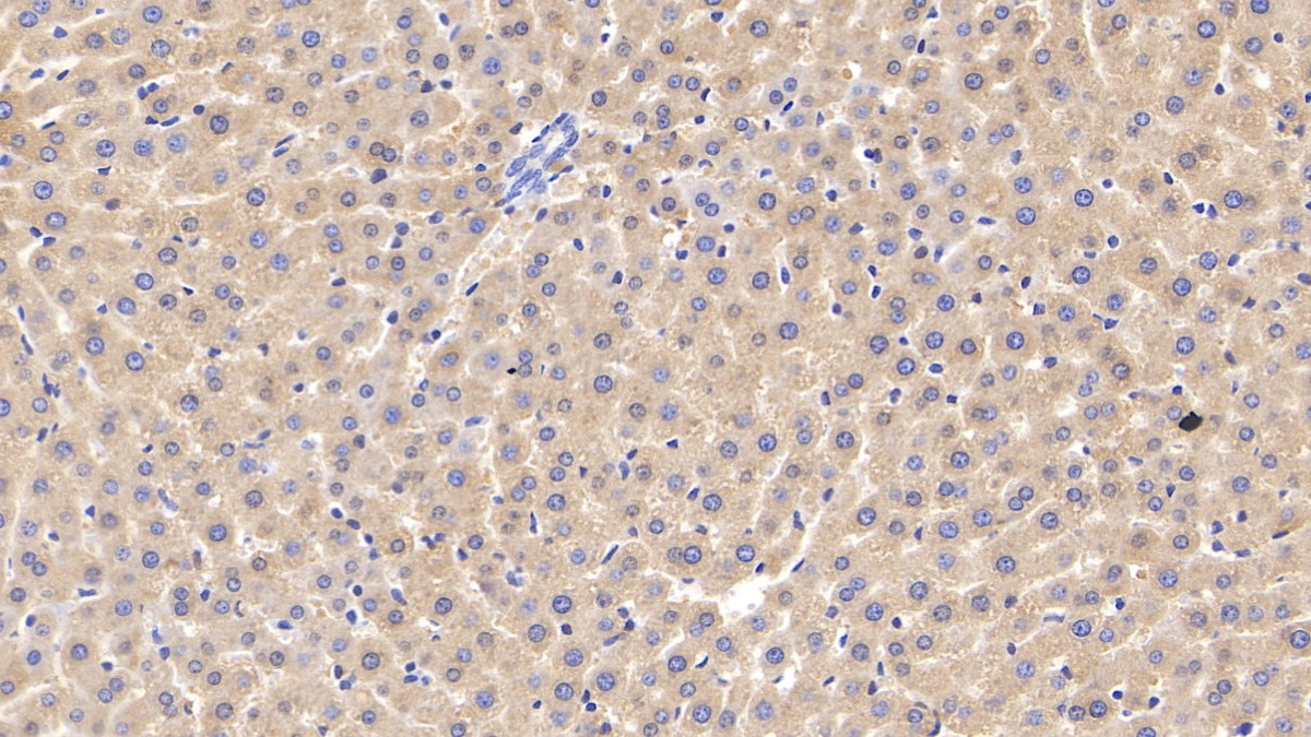 Polyclonal Antibody to Glycogen Phosphorylase, Liver (PYGL)