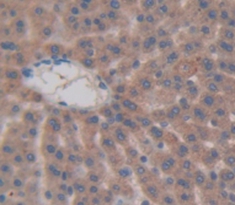 Polyclonal Antibody to Calcitonin Gene Related Peptide (CGRP)