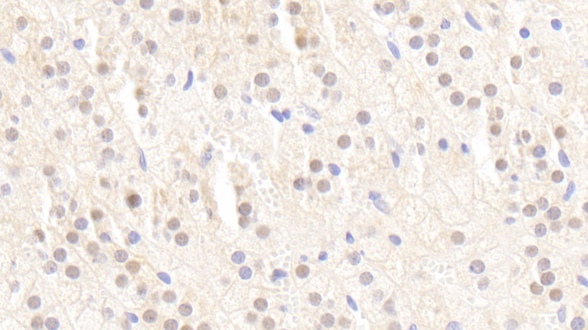 Polyclonal Antibody to Peroxisome Proliferator Activated Receptor Gamma (PPARg)