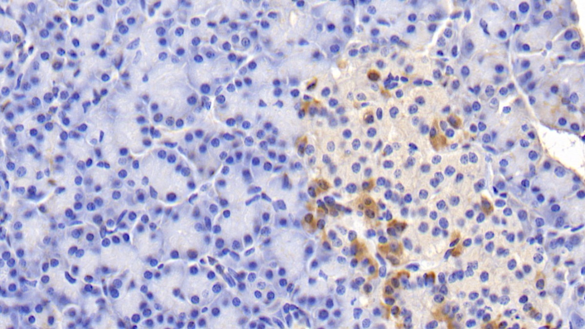 Polyclonal Antibody to Insulin Receptor (INSR)