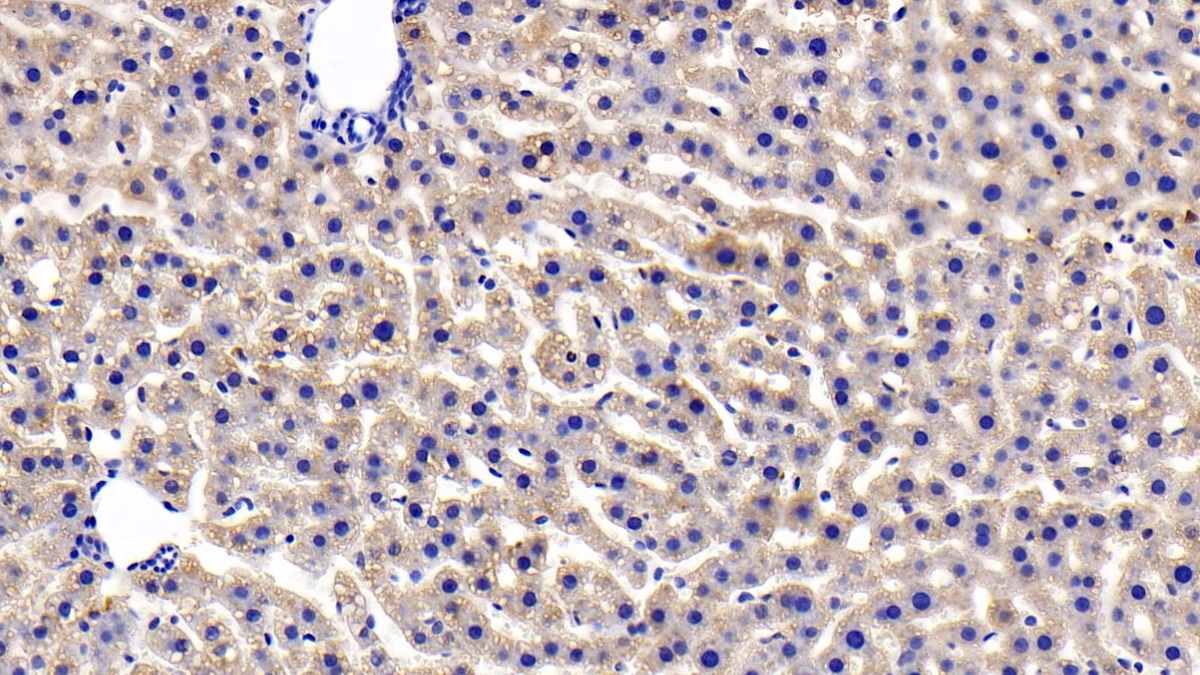 Polyclonal Antibody to Insulin Receptor (INSR)