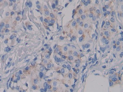 Polyclonal Antibody to Nephrin (NPHN)