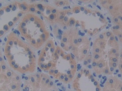 Polyclonal Antibody to Very Low Density Lipoprotein Receptor (VLDLR)