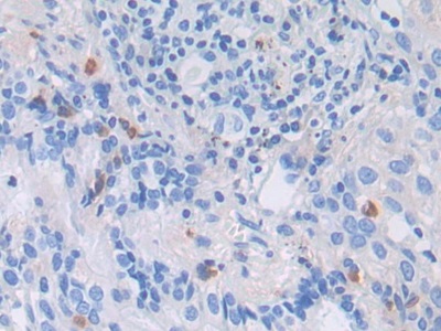 Polyclonal Antibody to Low Density Lipoprotein Receptor Related Protein 1 (LRP1)