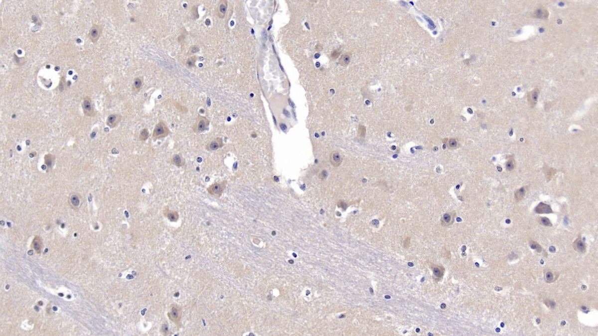 Polyclonal Antibody to Amyloid Precursor Protein (APP)