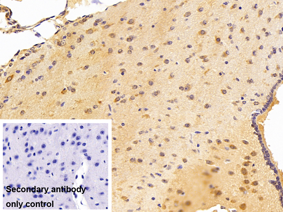 Polyclonal Antibody to Amyloid Precursor Protein (APP)