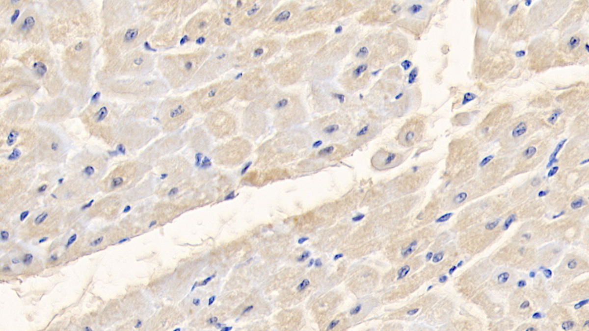 Polyclonal Antibody to Albumin (ALB)