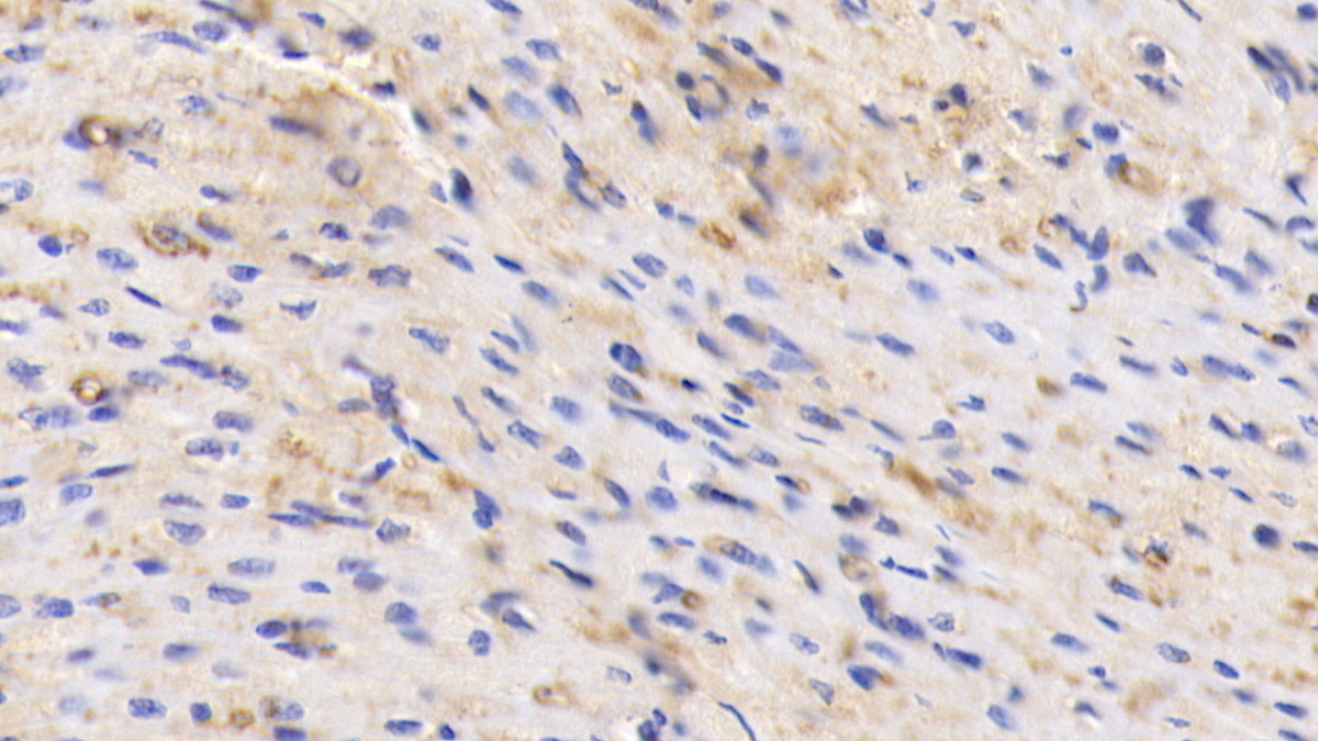 Polyclonal Antibody to Albumin (ALB)