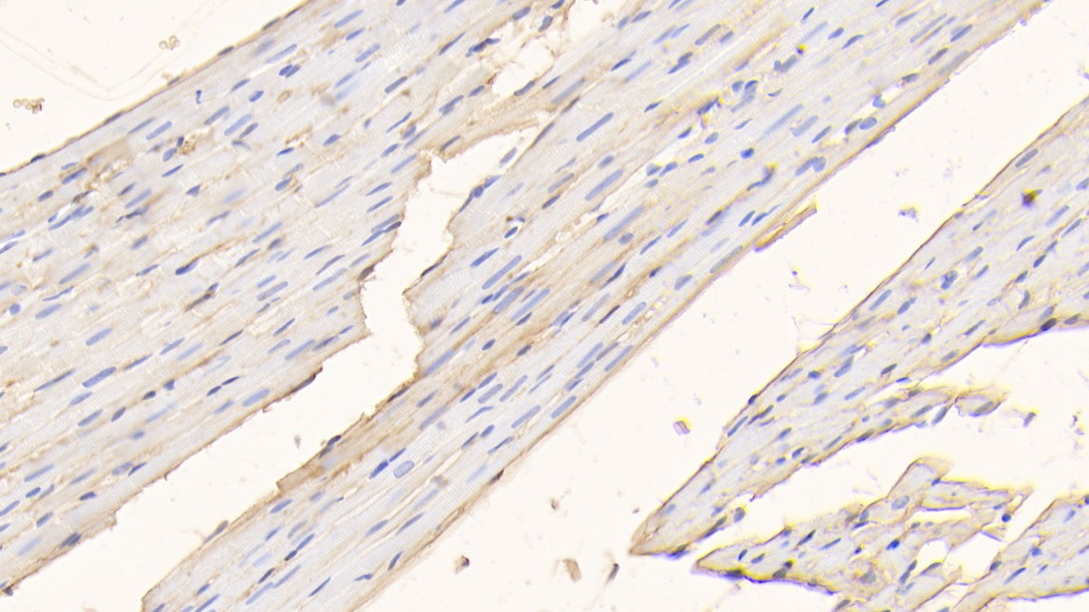 Polyclonal Antibody to Albumin (ALB)