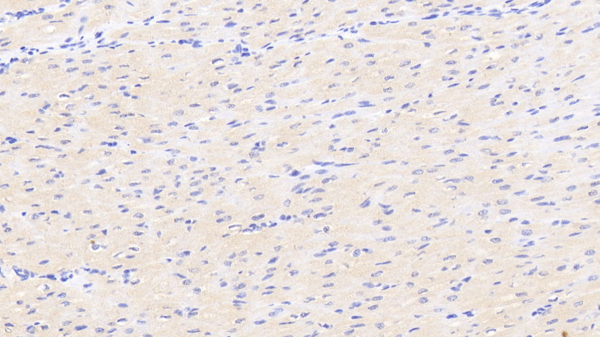 Polyclonal Antibody to Dickkopf Related Protein 2 (DKK2)