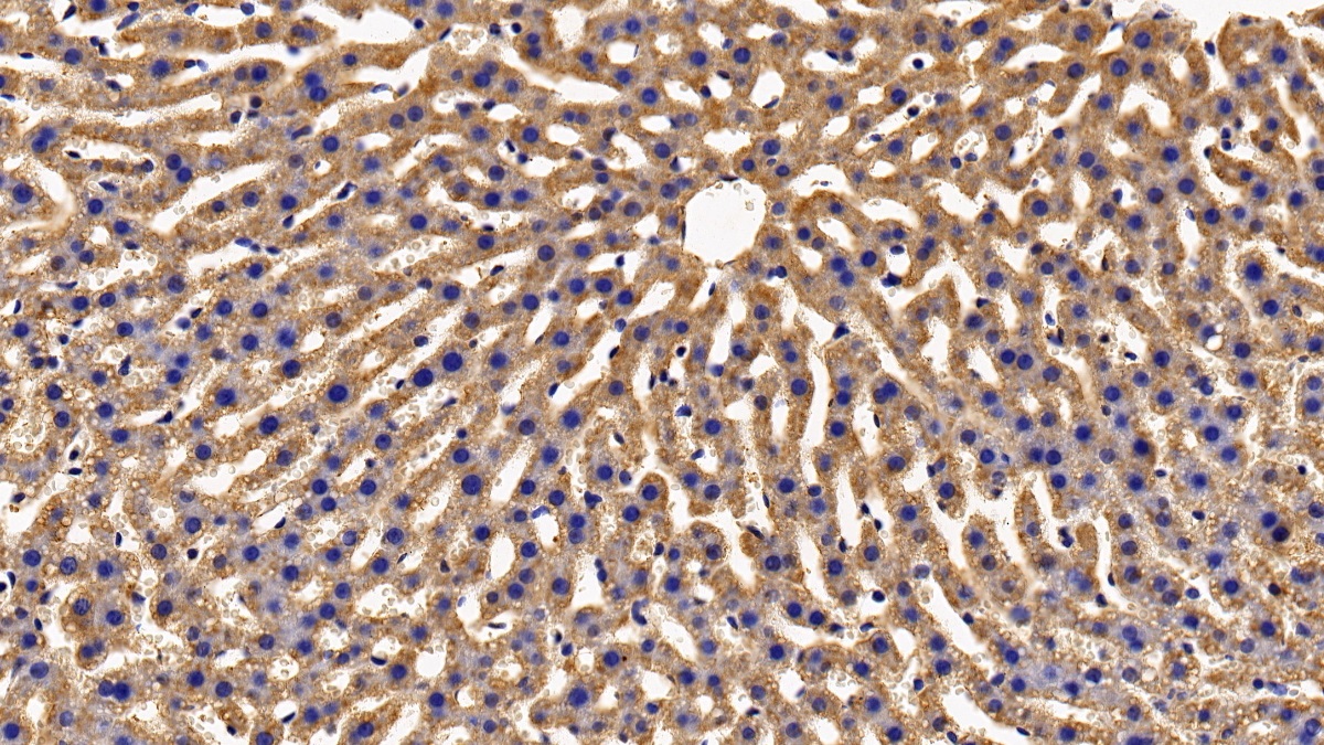 Polyclonal Antibody to Growth Hormone Receptor (GHR)