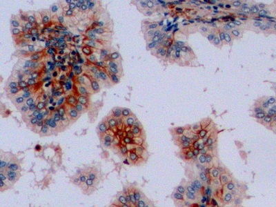 Polyclonal Antibody to Vimentin (VIM)