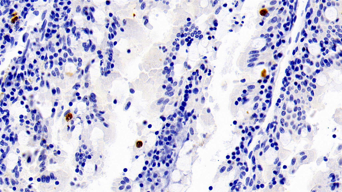 Polyclonal Antibody to S100 Calcium Binding Protein A12 (S100A12)