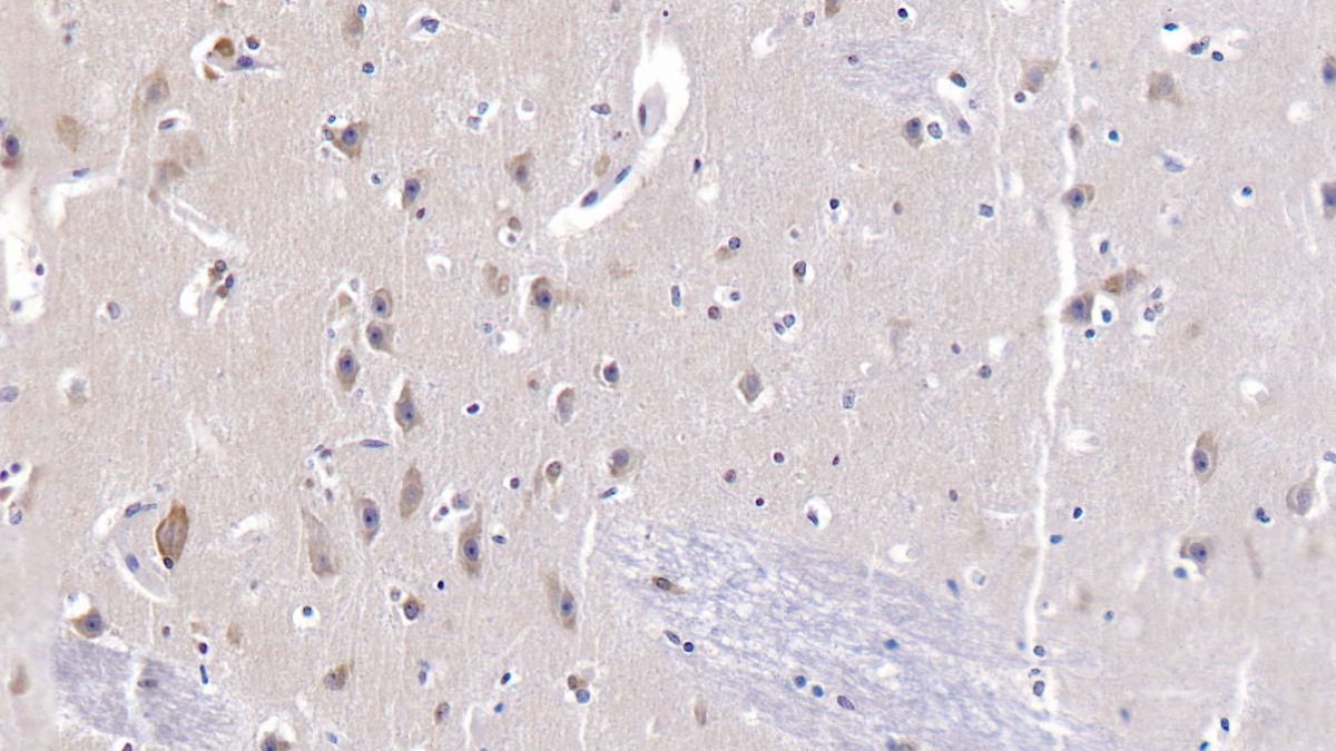 Polyclonal Antibody to Heat Shock 70kDa Protein 9 (HSPA9)