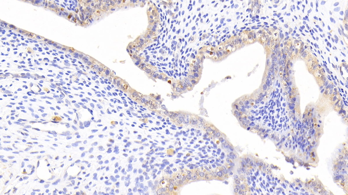 Polyclonal Antibody to Superoxide Dismutase 2, Mitochondrial (SOD2)