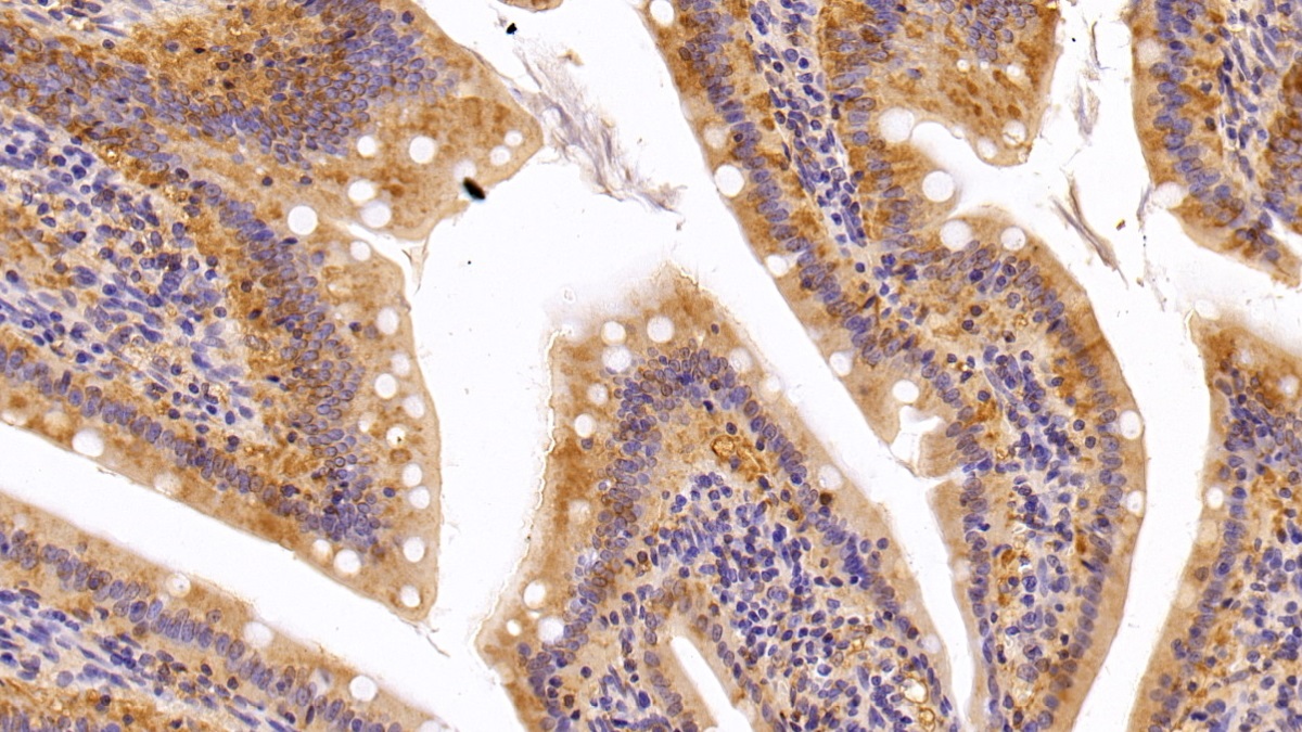 Polyclonal Antibody to Glutathione S Transferase Pi (GSTp)