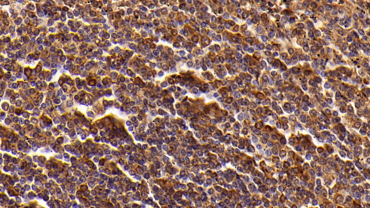 Polyclonal Antibody to Cluster Of Differentiation 8a (CD8a)