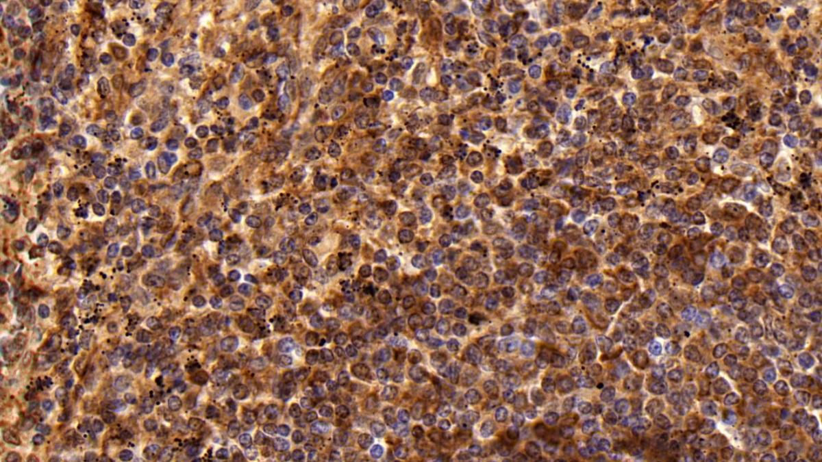 Polyclonal Antibody to Cluster Of Differentiation 8a (CD8a)