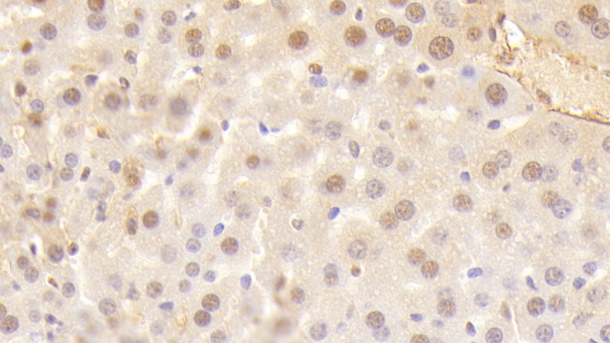 Polyclonal Antibody to Ectonucleoside Triphosphate Diphosphohydrolase 1 (ENTPD1)