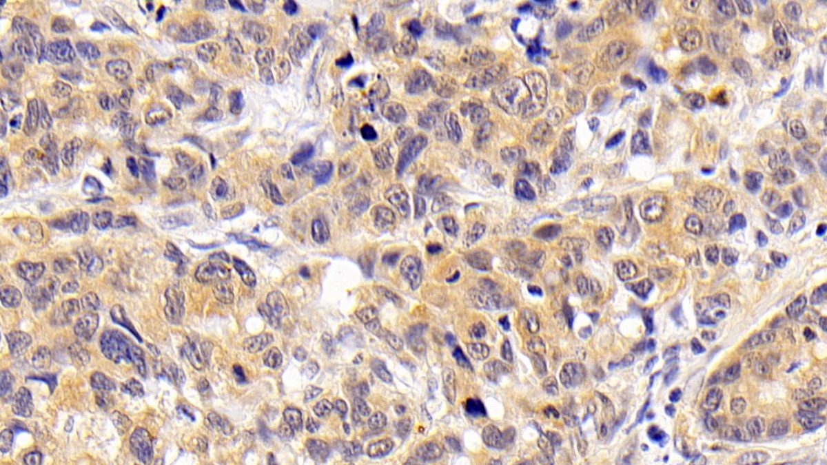 Polyclonal Antibody to Chemokine C-C-Motif Ligand 16 (CCL16)