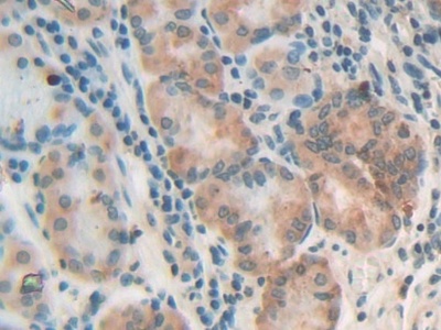 Polyclonal Antibody to Chondroitin Sulfate Proteoglycan 4 (CSPG4)