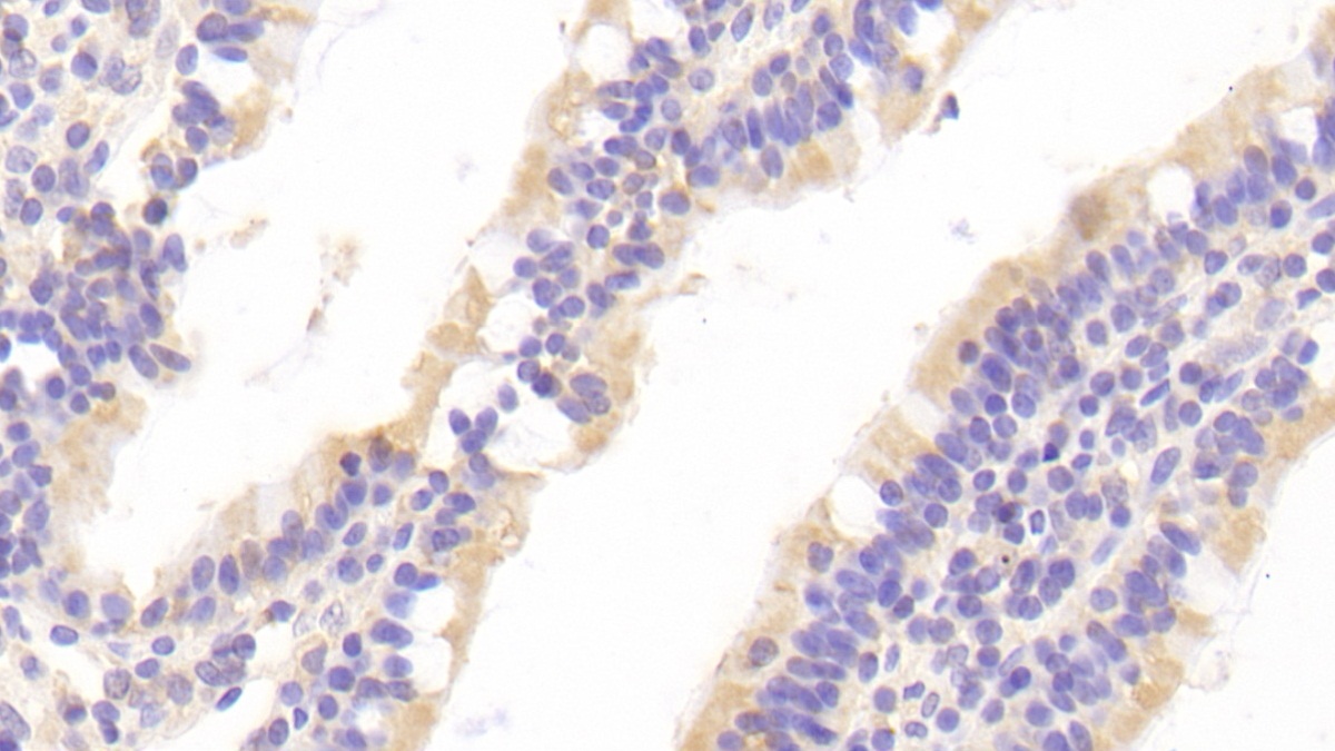 Polyclonal Antibody to Caspase 10 (CASP10)