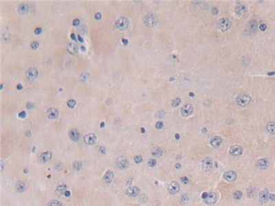 Polyclonal Antibody to Thioredoxin-interacting Protein (TXNIP)
