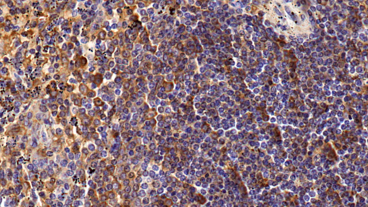 Polyclonal Antibody to Cluster Of Differentiation 4 (CD4)