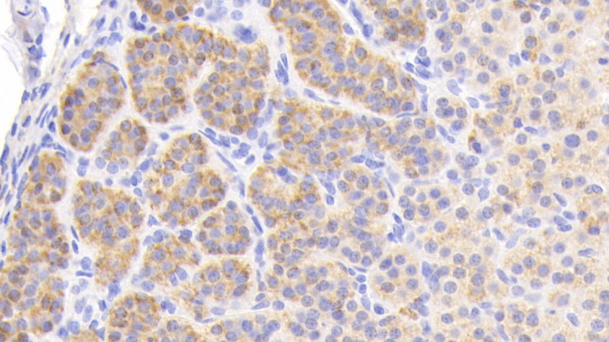 Polyclonal Antibody to Enkephalin (ENK)