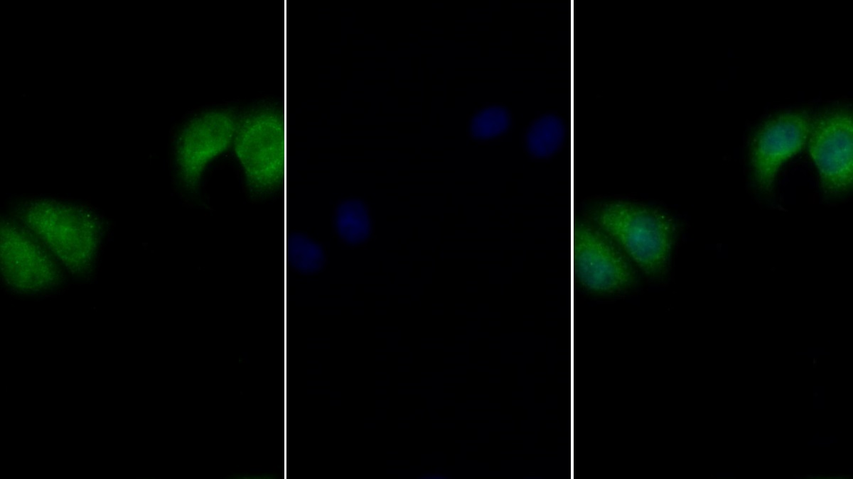 Polyclonal Antibody to Interleukin 27 Receptor Alpha (IL27Ra)