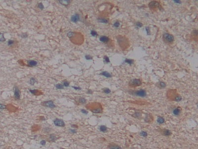 Polyclonal Antibody to Glia Maturation Factor Gamma (GMFg)